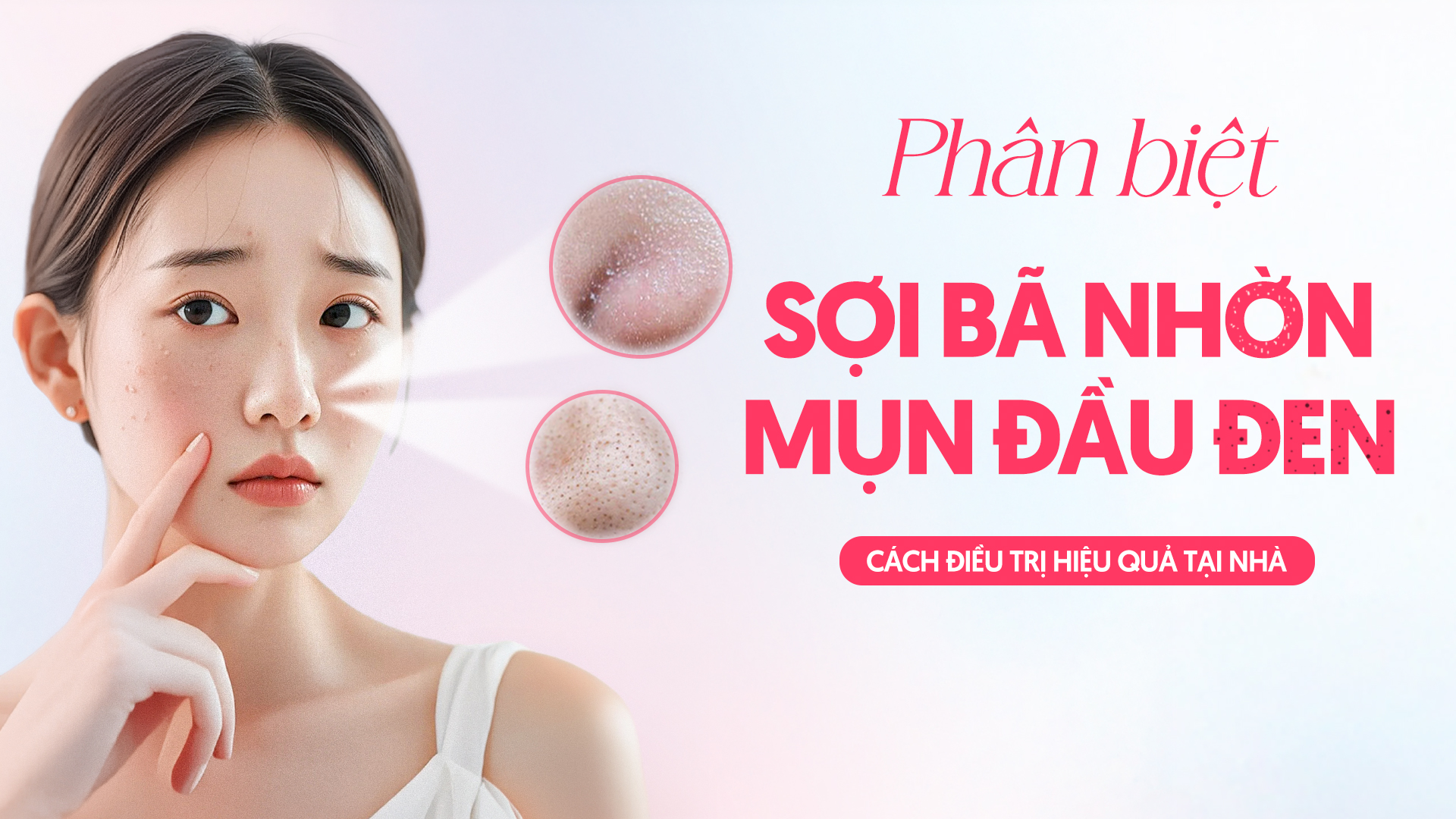 Phân biệt sợi bã nhờn và mụn đầu đen - Nguyên nhân & cách điều trị hiệu quả tại nhà